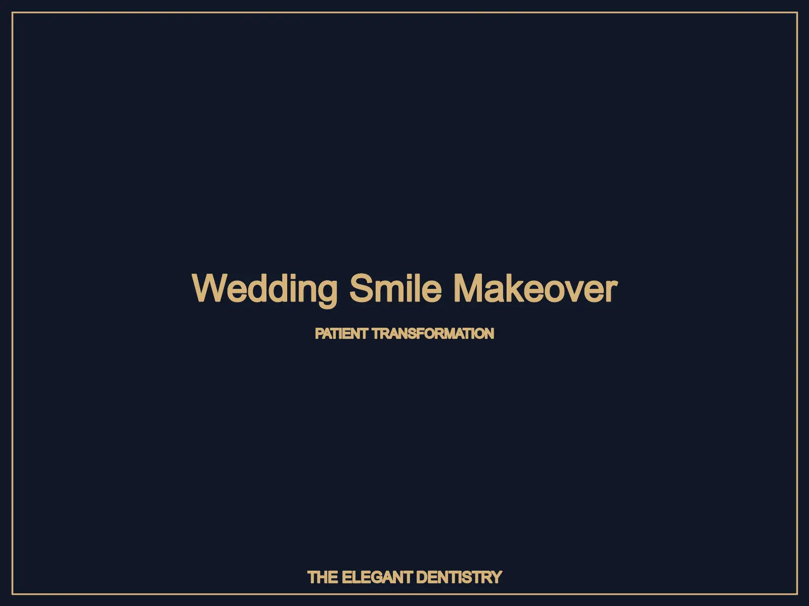 Wedding smile makeover patient transformation